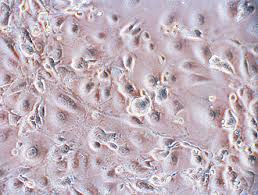 1-Cellule dei centenari riprogrammate a stadio embrionale